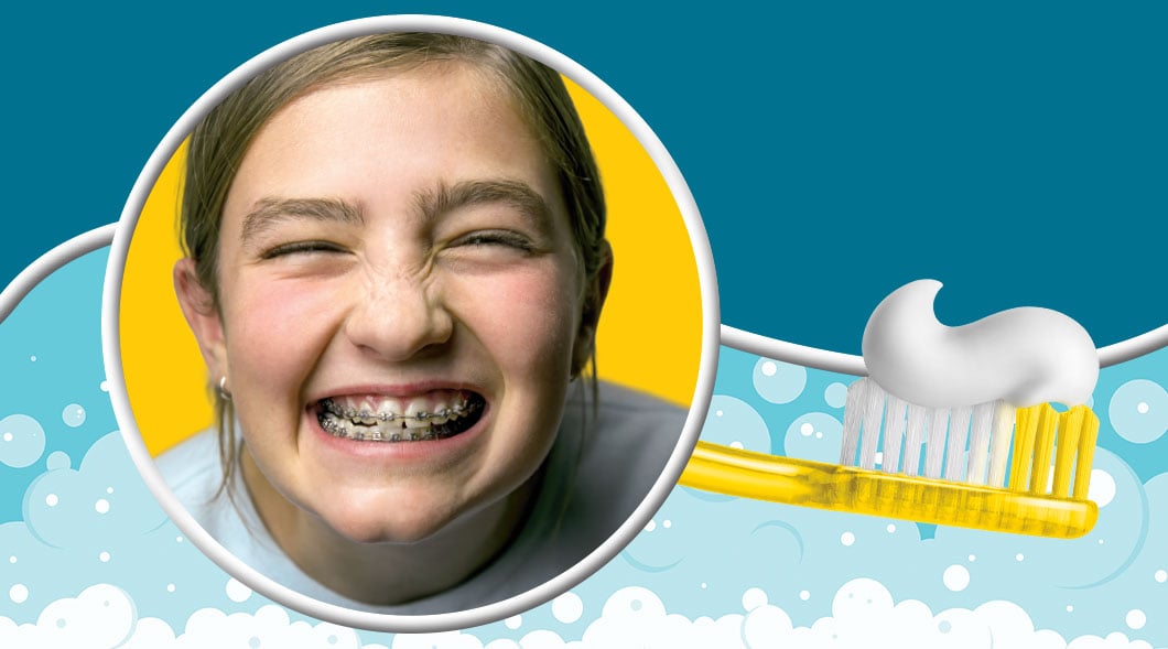 A girl with braces grins widely next to a toothbrush with toothpaste on the bristles